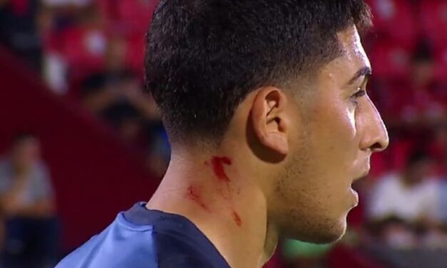 Antes del arranque del partido hubo agresiones contra Brey y Marchesín