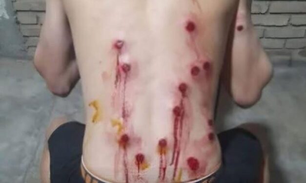 CHIMBAS: Grave denuncia de un joven por presunto abuso de autoridad