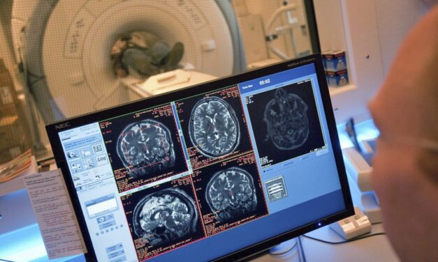 Qué tipo de enfermedades se detectan con una resonancia magnética