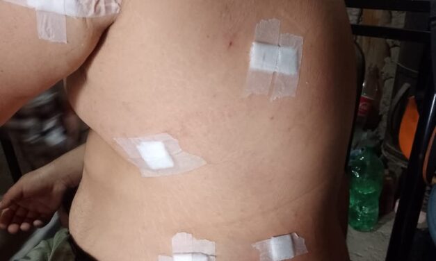 Brutal ataque a un joven en Caucete: Le dieron siete puntazos para robarle el celular