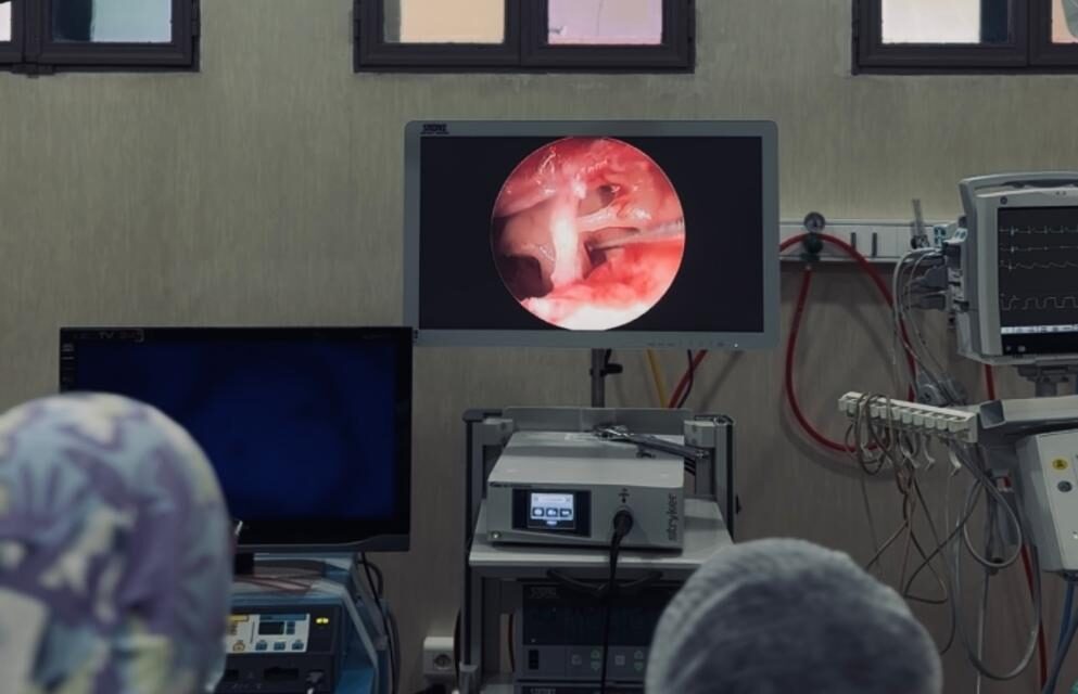 Un hito médico: El Marcial Quiroga realizó su primera cirugía endoscópica de oído
