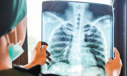 Hospital Marcial Quiroga organiza ciclo de charlas sobre screening de cáncer de pulmón