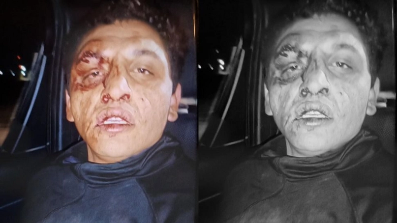 Terror en Chimbas: Una mujer fue retenida y amenazada con un cuchillo