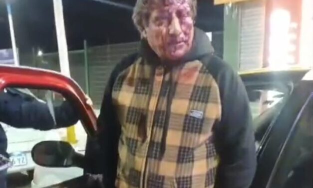 Urgente: Taxista brutalmente atacado en un robo