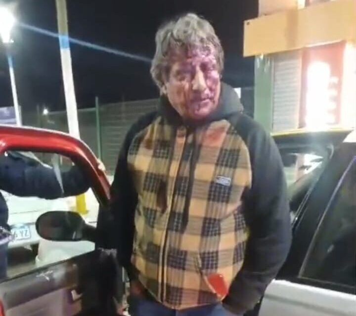 Urgente: Taxista brutalmente atacado en un robo