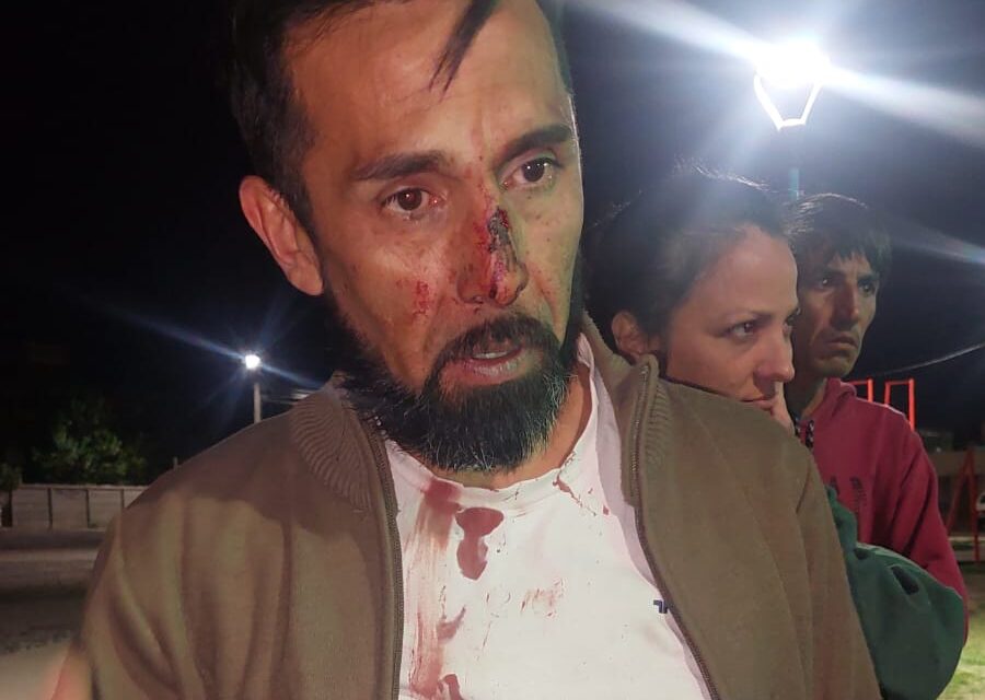 Violencia y robo en Rawson: Vecinos denuncian agresión de familia conflictiva