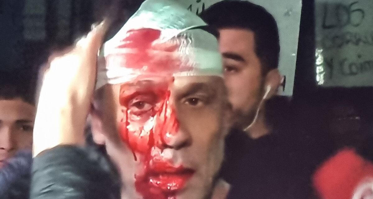 Un periodista fue gravemente herido por un botellazo