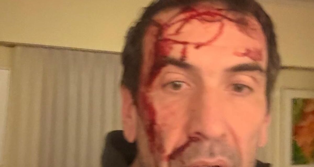 Asaltaron y golpearon a Pablo Cervi, candidato de la Libertad Avanza en Neuquén
