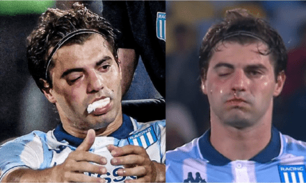 Santiago Sosa tiene fractura de maxilar por el golpe de Marcos Rojo y es duda para la revancha ante Flamengo