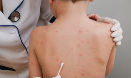 Con críticas a Nación, Provincia alerta por avance de otro brote de sarampión