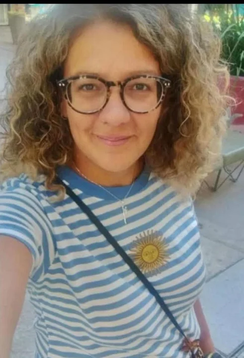 Murió la mujer que había sufrido graves quemaduras y el caso conmueve a ...
