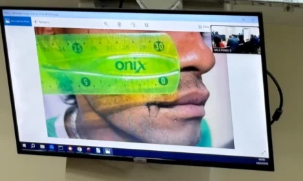 Fiscalía sostiene que el jugador de Trinidad golpeó por enojo tras la derrota y sin provocación previa