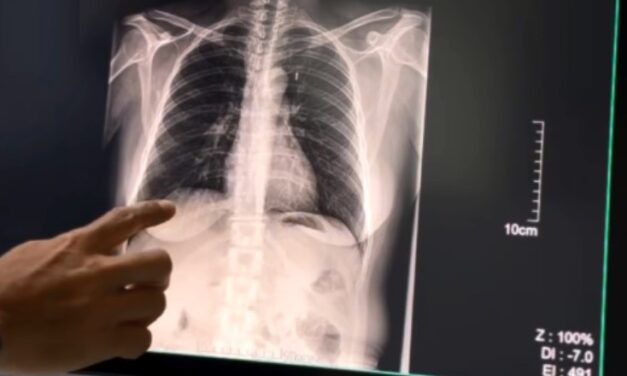 Cuatro de cada diez pacientes lograron dejar de fumar gracias a un programa del Hospital Marcial Quiroga