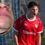 Fractura de nariz y dos horas de golpes: la brutal denuncia por violencia de género contra un jugador de Independiente