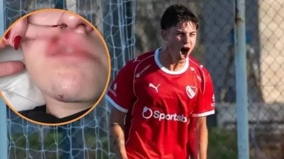 Fractura de nariz y dos horas de golpes: la brutal denuncia por violencia de género contra un jugador de Independiente