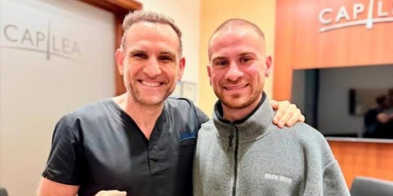 Alexis Mac Allister cumplió y se implantó pelo antes de volver al fútbol inglés