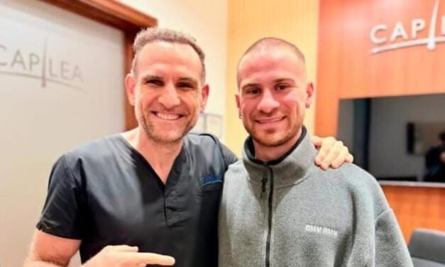 Alexis Mac Allister cumplió y se implantó pelo antes de volver al fútbol inglés