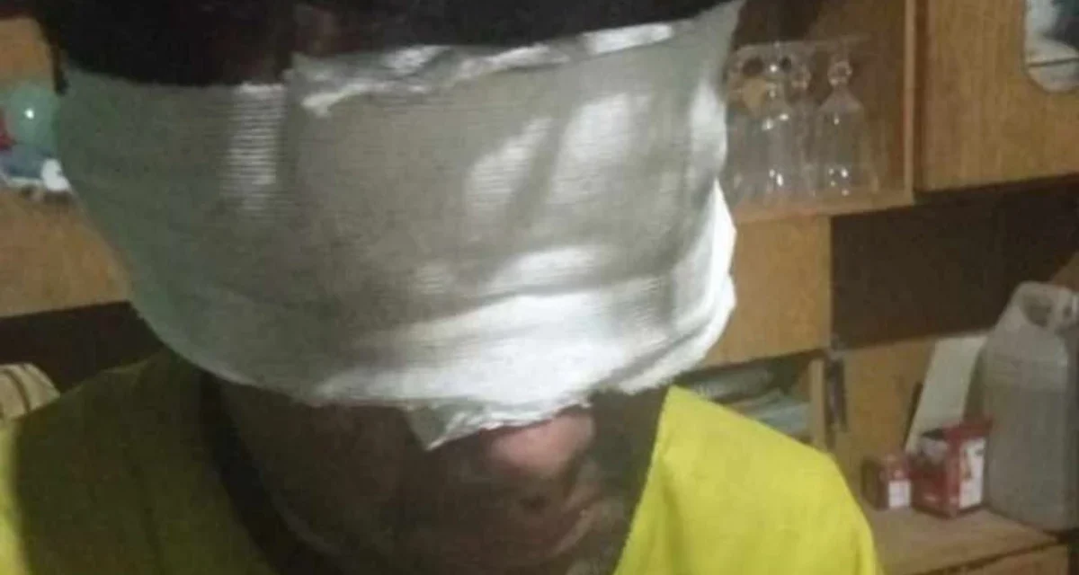 Combatiendo el fuego hasta las últimas consecuencias: un bombero terminó con los ojos vendados