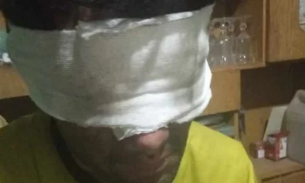 Combatiendo el fuego hasta las últimas consecuencias: un bombero terminó con los ojos vendados
