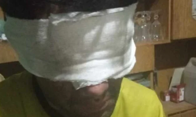 Combatiendo el fuego hasta las últimas consecuencias: un bombero terminó con los ojos vendados