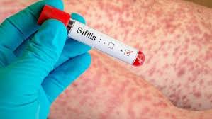 Las infecciones de transmisión sexual vuelven a encender las alarmas: la sífilis es la que más preocupa