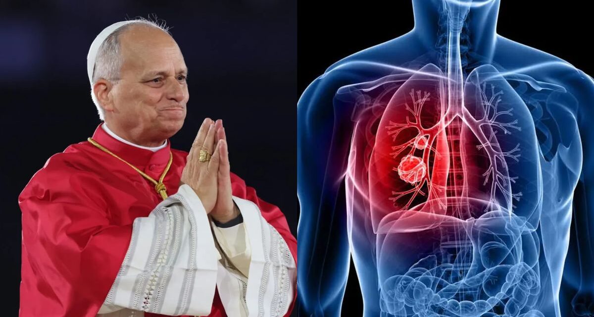 Cómo será la operación del papa León XIV por un nódulo pulmonar y cuánto tiempo tardará en recuperarse