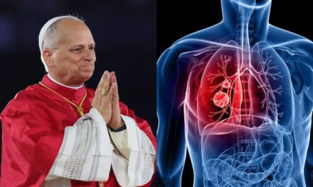 Cómo será la operación del papa León XIV por un nódulo pulmonar y cuánto tiempo tardará en recuperarse